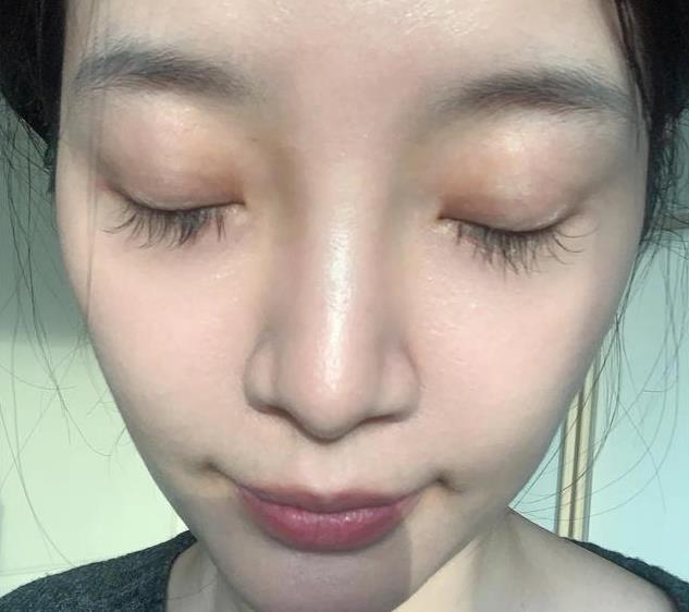 3种调料正在“悄悄”留下你皮下的黑色素提醒女性平时少吃(图2)